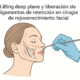 Lifting deep plane y liberación de ligamentos de retención en cirugía de rejuvenecimiento facial